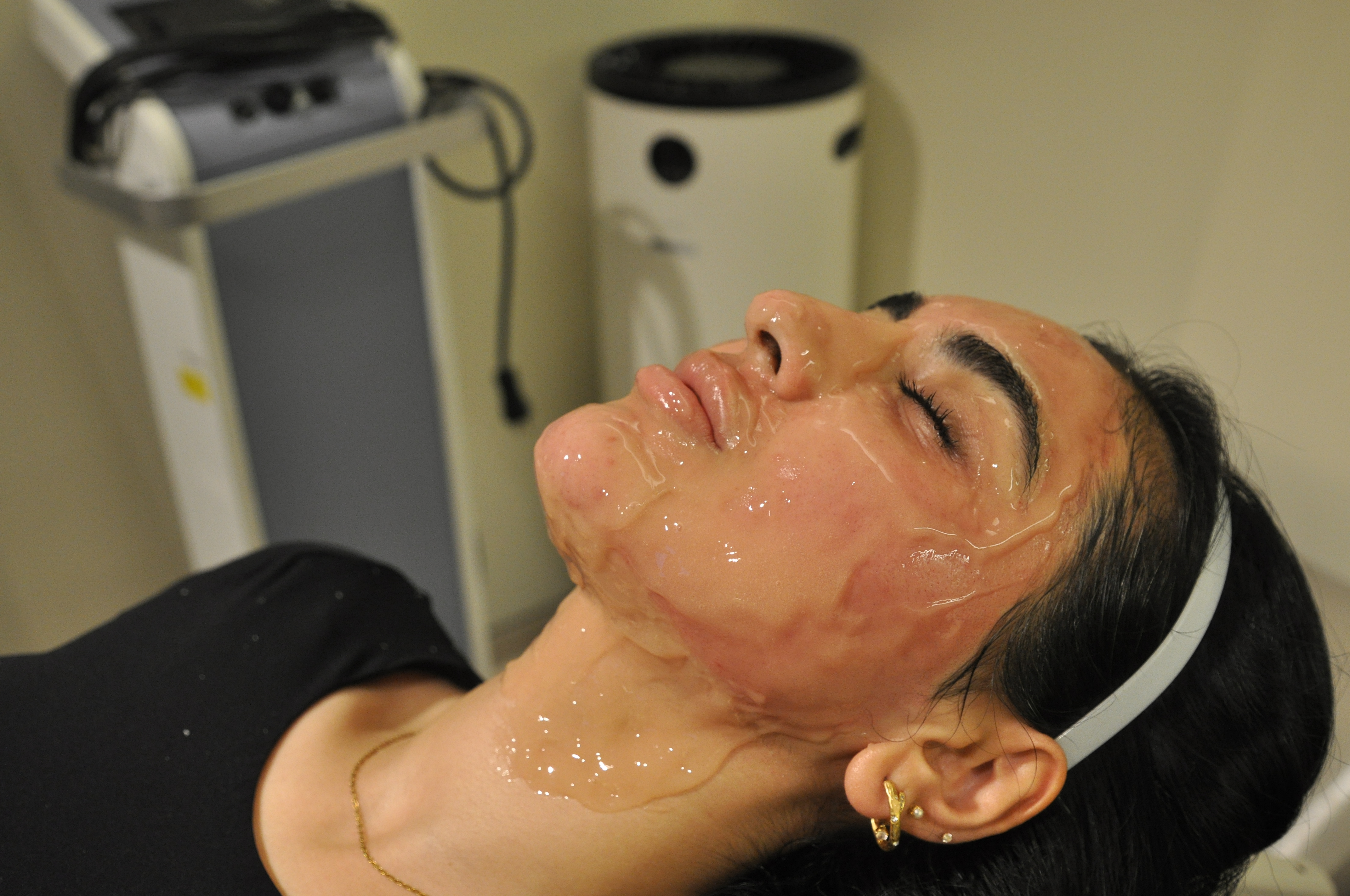 Woman receiving carboxytherapy treatment with gel applied to her face.