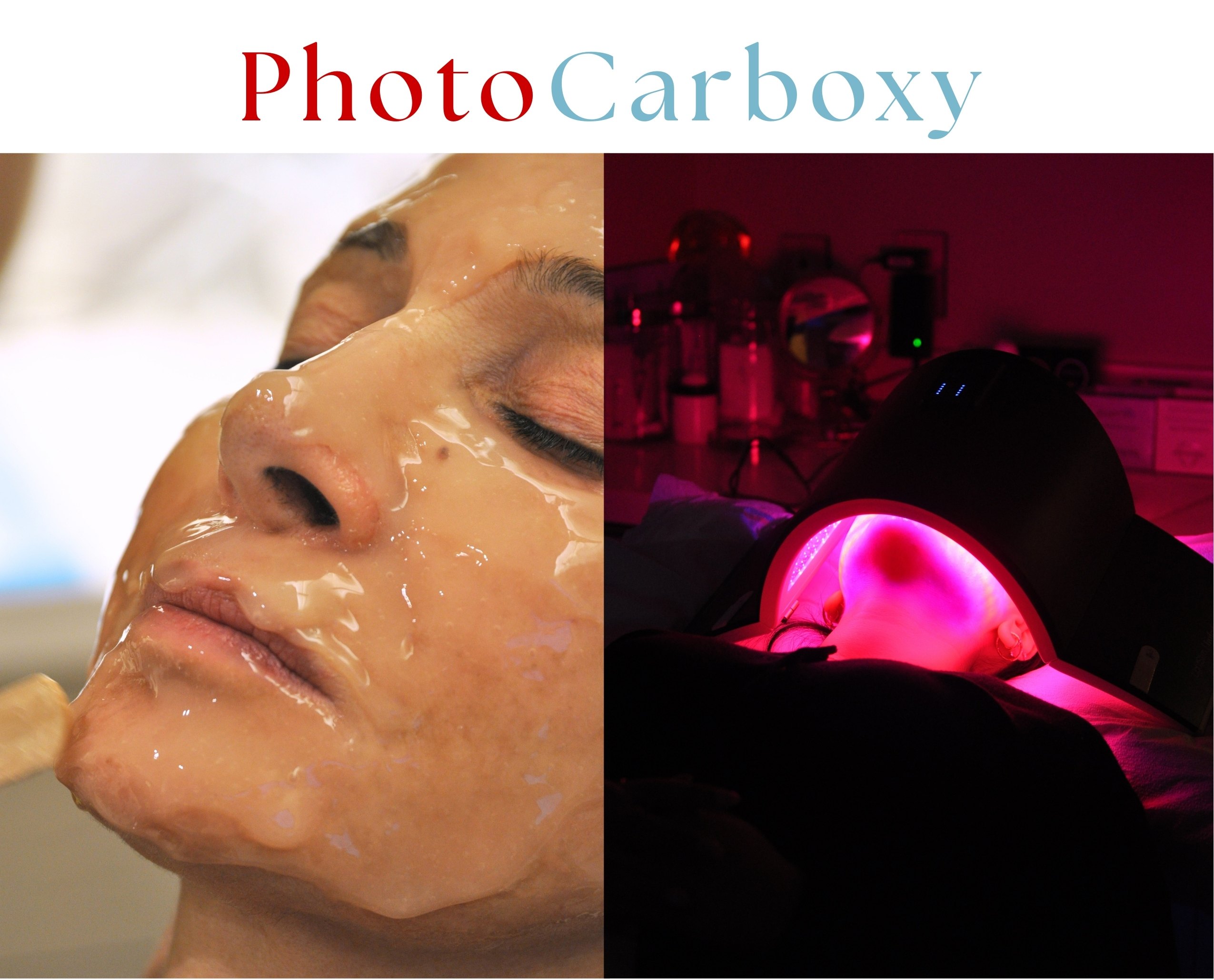 Split image of PhotoCarboxy: a client with carboxytherapy gel mask on the face and the same client under red LED light therapy.