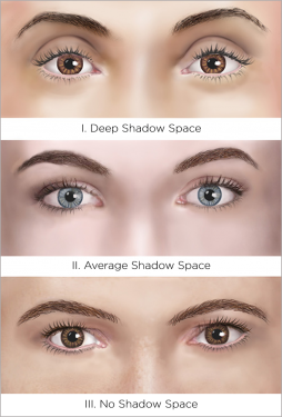 Upper Eyelid Shape_Caption_Bottom_Center_0.png