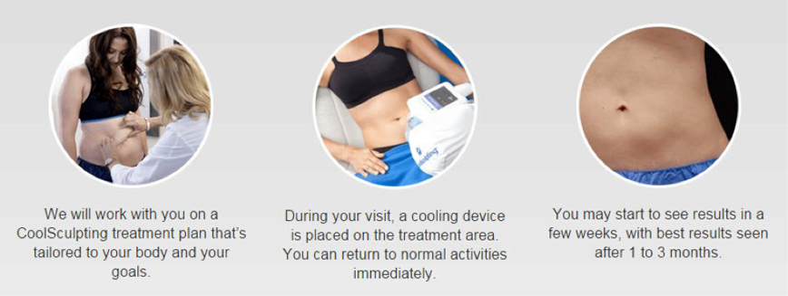 CoolSculpting2.png